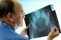 osteoporoz tahlilleri